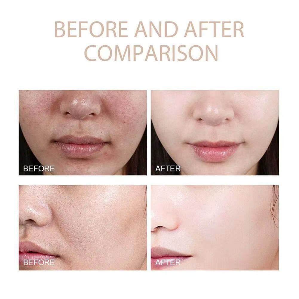 Dr.Melaxin White Rice + Black Rice Ampoule Exfoliating Essence Deep Moisturizing Serum Gentle Non-Irritating Smoothing Skin Care