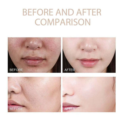 Dr.Melaxin White Rice + Black Rice Ampoule Exfoliating Essence Deep Moisturizing Serum Gentle Non-Irritating Smoothing Skin Care